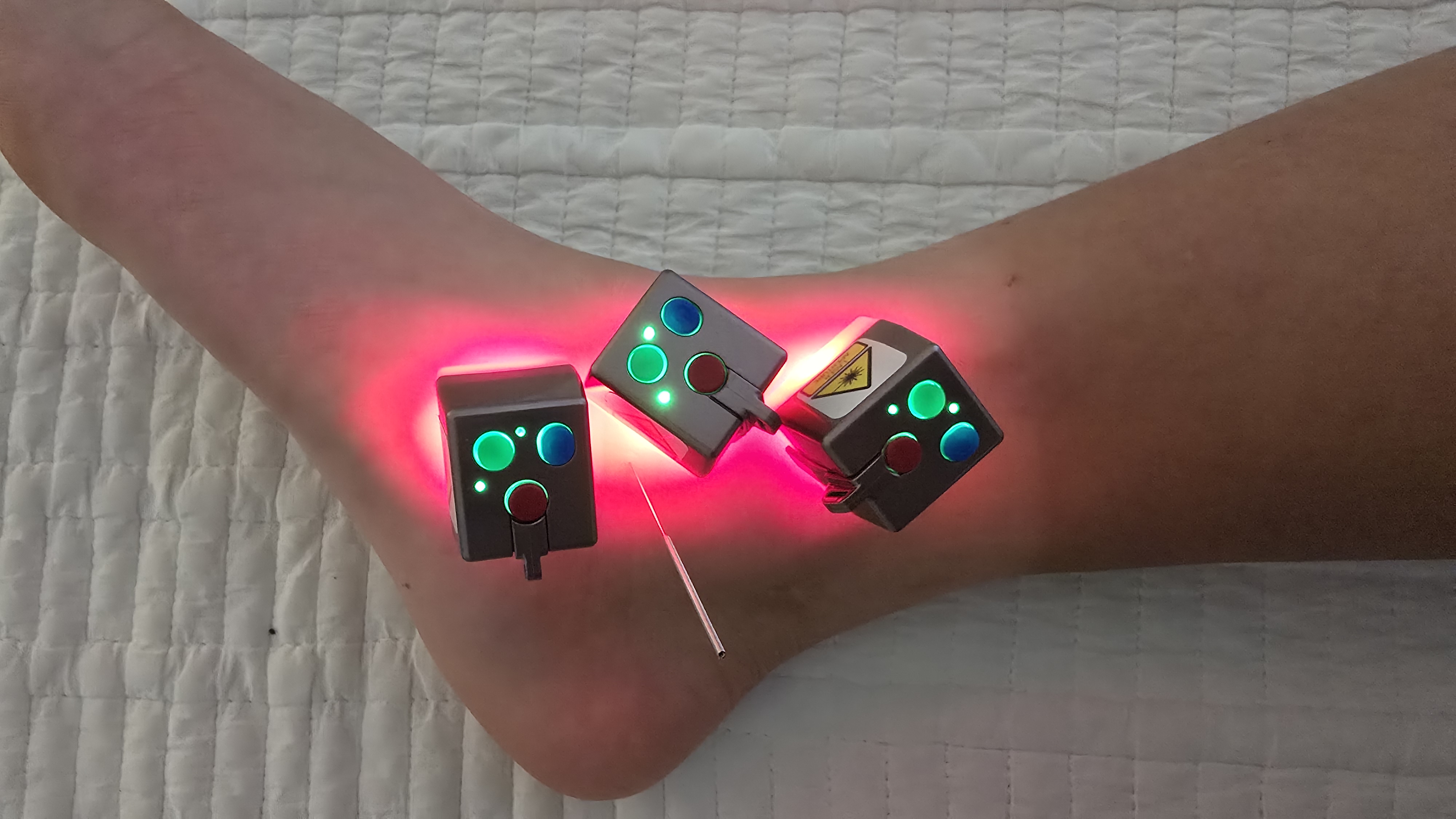 RootCare home-use device example near the ankle