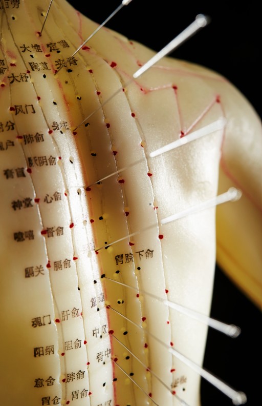 Tension headache and stress relief themed blog image