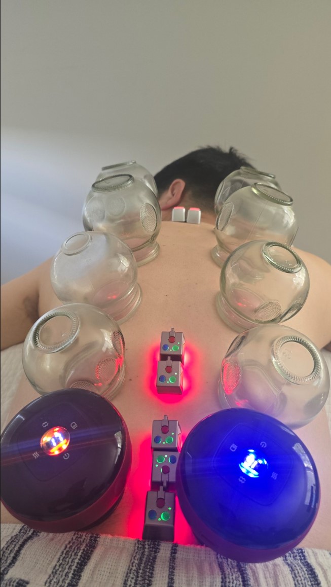 Cupping support option