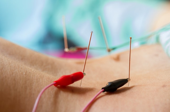 Electro-acupuncture care option